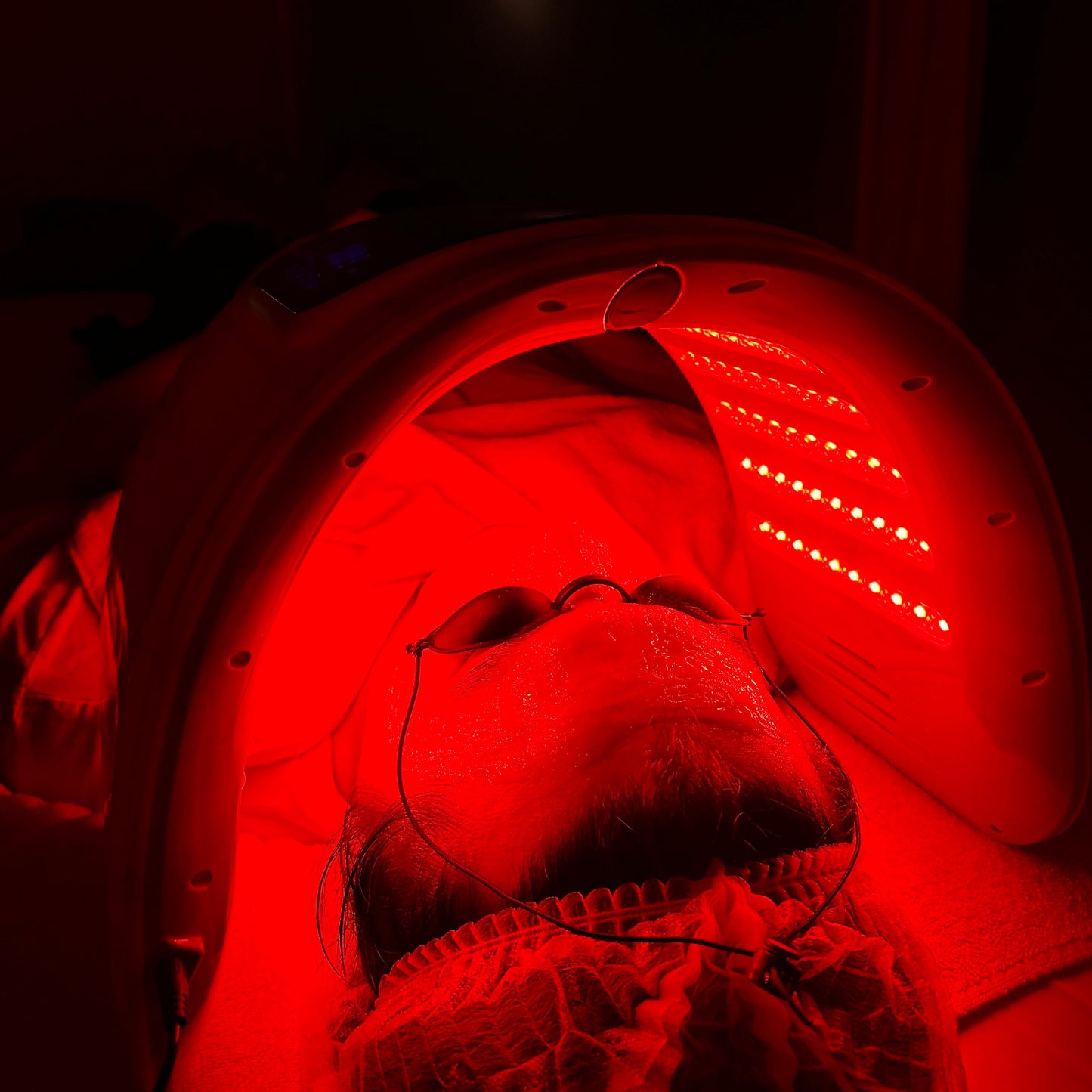 Dp4™ Microneedling + LED Light Therapy